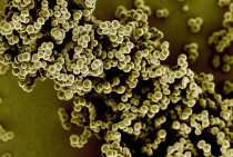 MRSA Superbug’s Resistance to Antibiotics is Broken